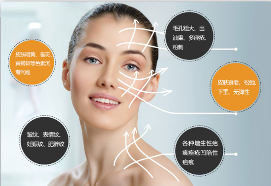 火爆全球的抗衰美容儀器——熱瑪吉